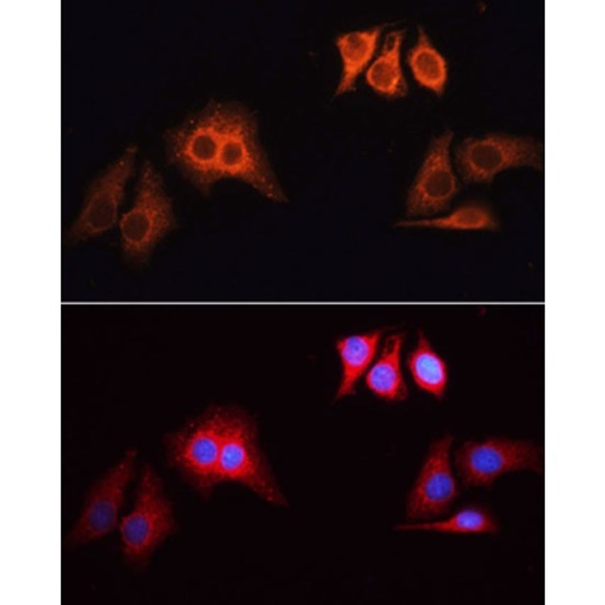 ABCLONAL Rhodamine (Tritc) Goat Anti-Rabbit Igg (H+L)
